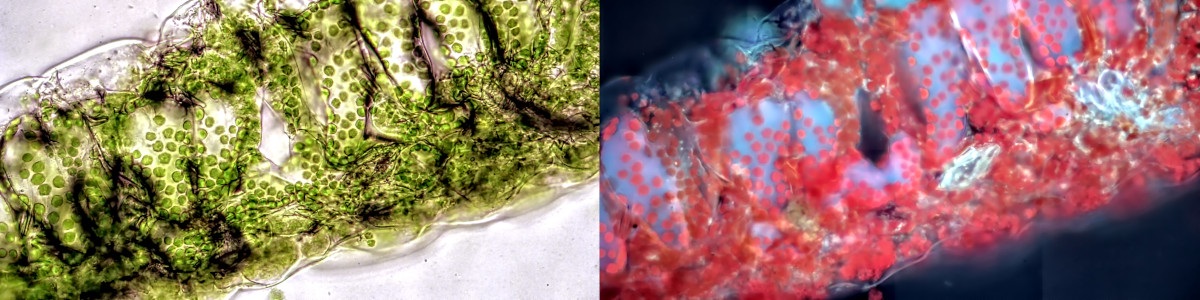 Blattquerschnitte unter dem Fluoreszenzmikroskop
